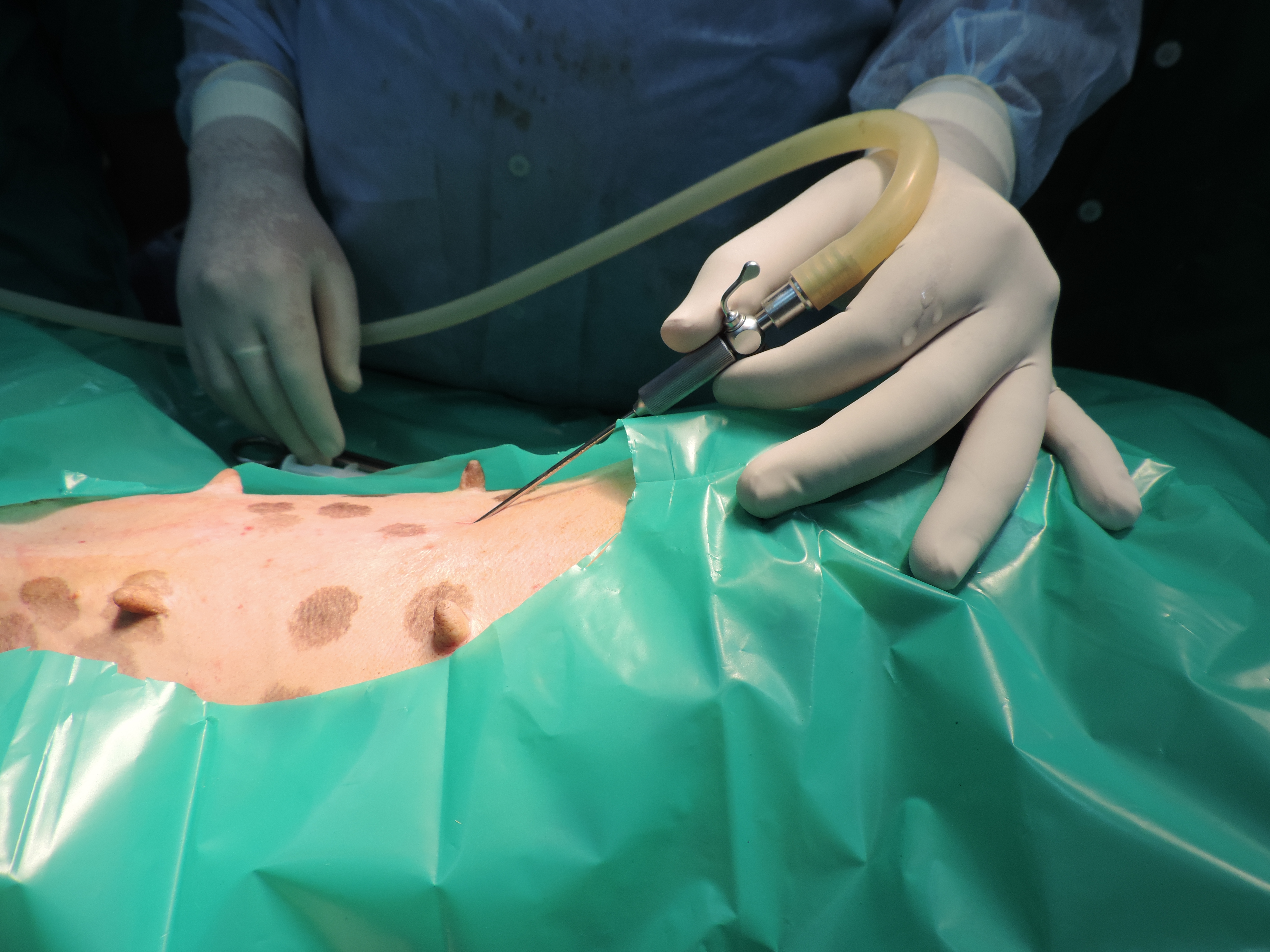 surgery-2